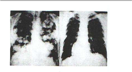 epub cell adhesion and communication mediated by the cea family